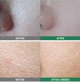 SUNGBOON EDITOR - Green Tomato Pore Peeling Jumbo Pad