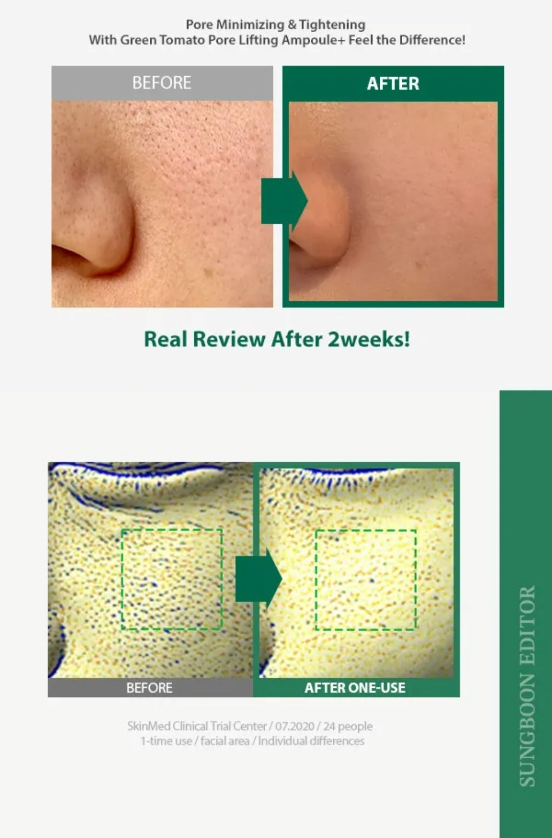 SUNGBOON EDITOR - Green Tomato Pore Lifting Ampoule+