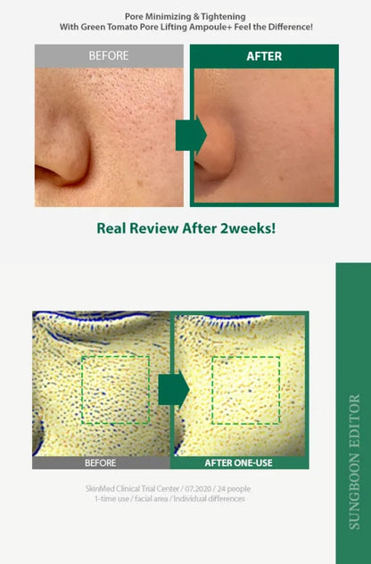 SUNGBOON EDITOR - Green Tomato Pore Lifting Ampoule+